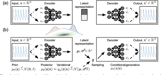 Figure 1 for DeepClean -- self-supervised artefact rejection for intensive care waveform data using generative deep learning