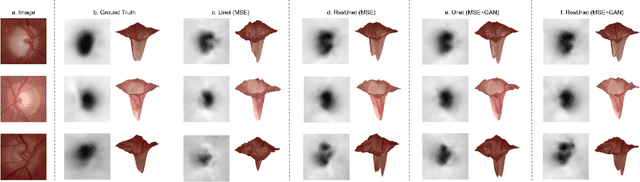 Figure 3 for Monocular Retinal Depth Estimation and Joint Optic Disc and Cup Segmentation using Adversarial Networks