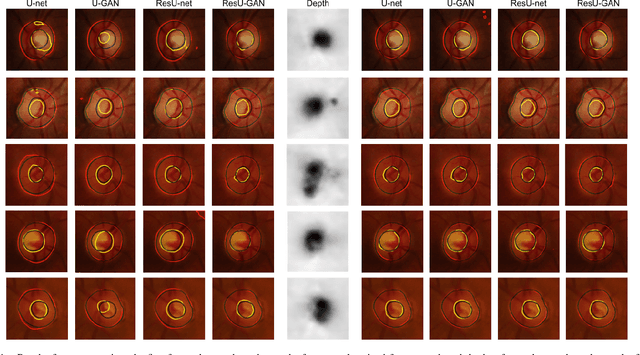 Figure 4 for Monocular Retinal Depth Estimation and Joint Optic Disc and Cup Segmentation using Adversarial Networks