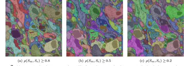 Figure 3 for A Context-aware Delayed Agglomeration Framework for Electron Microscopy Segmentation