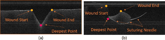 Figure 4 for Toward Autonomous Robotic Micro-Suturing using Optical Coherence Tomography Calibration and Path Planning