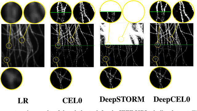 Figure 4 for DeepCEL0 for 2D Single Molecule Localization in Fluorescence Microscopy