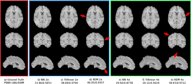 Figure 4 for A Resolution Enhancement Plug-in for Deformable Registration of Medical Images