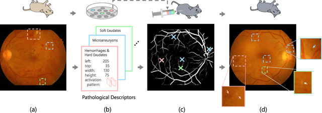 Figure 1 for Explainable Diabetic Retinopathy Detection and Retinal Image Generation