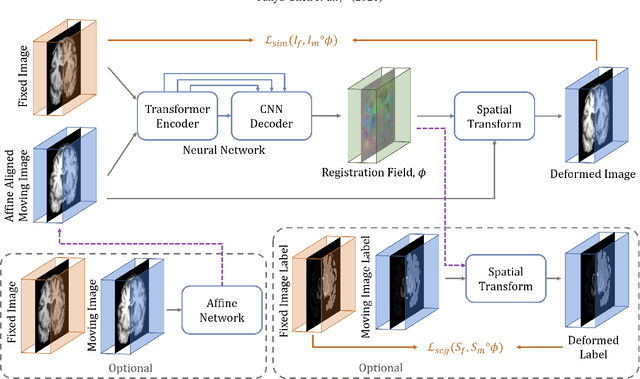 Figure 1 for TransMorph: Transformer for unsupervised medical image registration