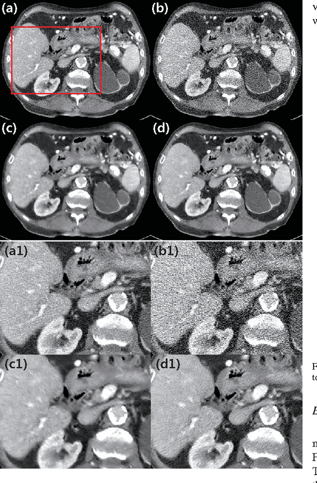 Figure 2 for Wavelet Domain Residual Network  for Low-Dose X-ray CT Reconstruction