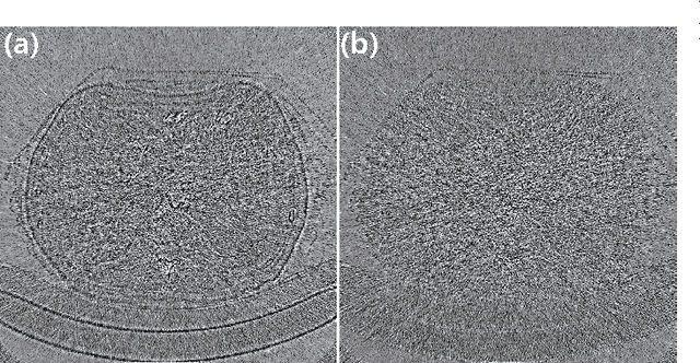 Figure 3 for Wavelet Domain Residual Network  for Low-Dose X-ray CT Reconstruction