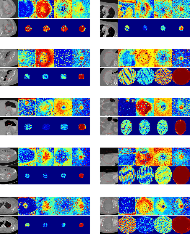 Figure 4 for Transformer Lesion Tracker