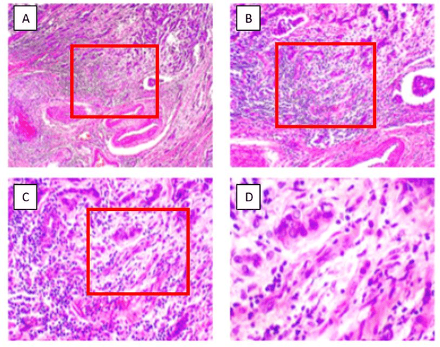 Figure 2 for Reduction of Surgical Risk Through the Evaluation of Medical Imaging Diagnostics