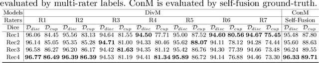 Figure 2 for Learning self-calibrated optic disc and cup segmentation from multi-rater annotations