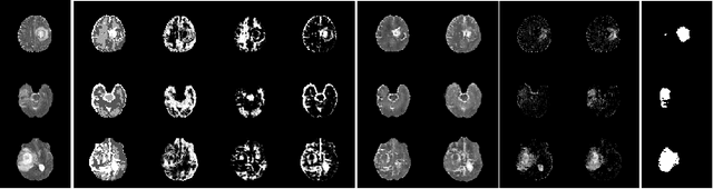 Figure 3 for Unsupervised Anomaly Segmentation using Image-Semantic Cycle Translation
