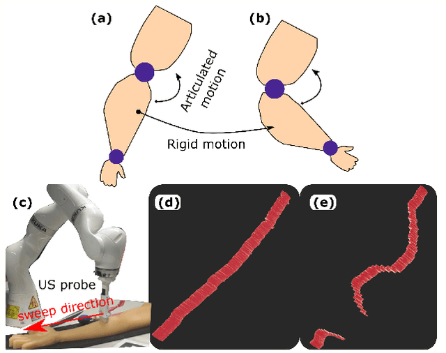 Figure 1 for Precise Repositioning of Robotic Ultrasound: Improving Registration-based Motion Compensation using Ultrasound Confidence Optimization
