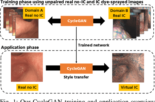 Figure 1 for Stomach 3D Reconstruction Based on Virtual Chromoendoscopic Image Generation