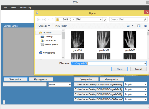 Figure 4 for Osteoarthritis Disease Detection System using Self Organizing Maps Method based on Ossa Manus X-Ray