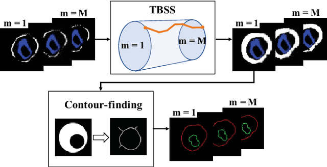 Figure 1 for Plaque segmentation via masking of the artery wall