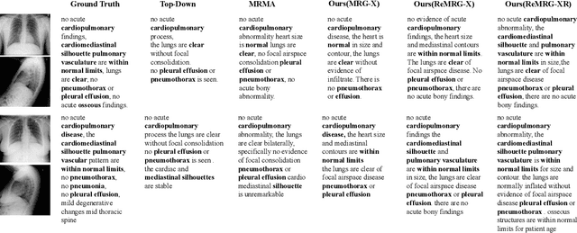Figure 3 for Reinforced Medical Report Generation with X-Linear Attention and Repetition Penalty