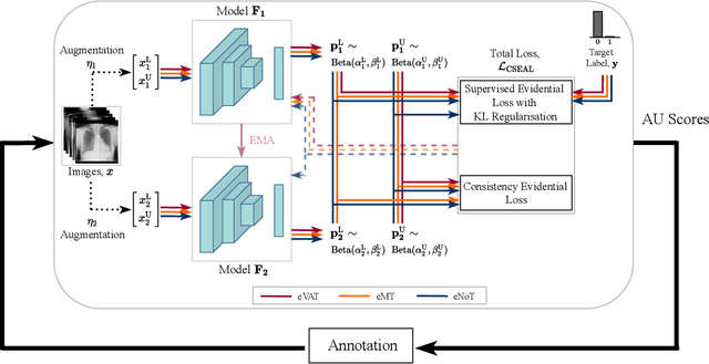 Figure 1 for Consistency-Based Semi-supervised Evidential Active Learning for Diagnostic Radiograph Classification