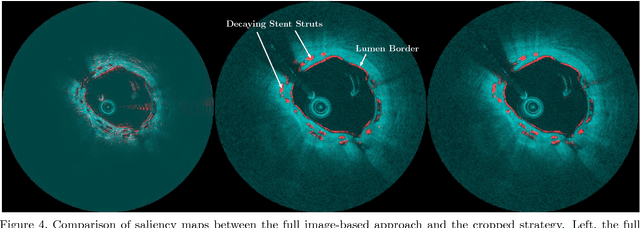 Figure 4 for Bioresorbable Scaffold Visualization in IVOCT Images Using CNNs and Weakly Supervised Localization