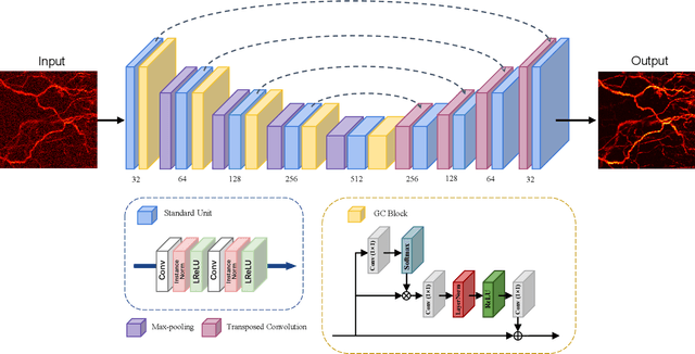 Figure 1 for De-Noising of Photoacoustic Microscopy Images by Deep Learning