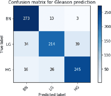 Figure 4 for An attention-based multi-resolution model for prostate whole slide imageclassification and localization