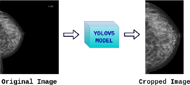 Figure 1 for Transparency strategy-based data augmentation for BI-RADS classification of mammograms