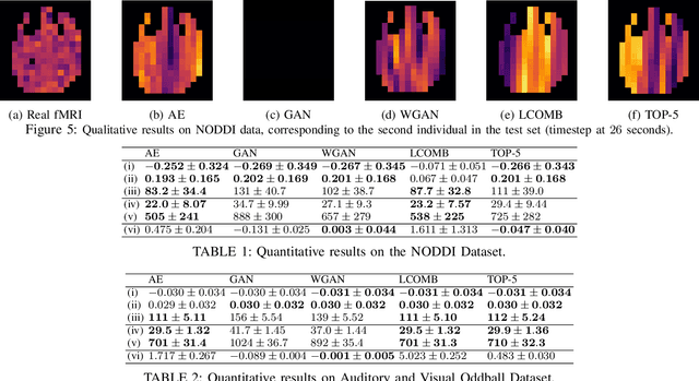 Figure 2 for EEG to fMRI Synthesis: Is Deep Learning a candidate?