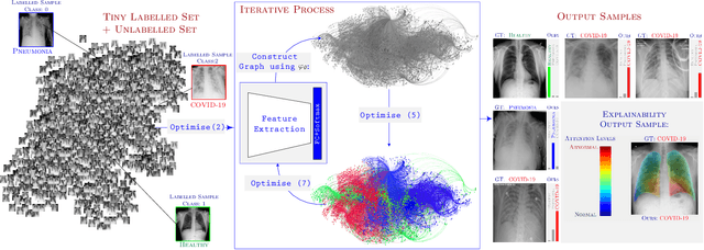 Figure 1 for GraphXCOVID: Explainable Deep Graph Diffusion Pseudo-Labelling for Identifying COVID-19 on Chest X-rays