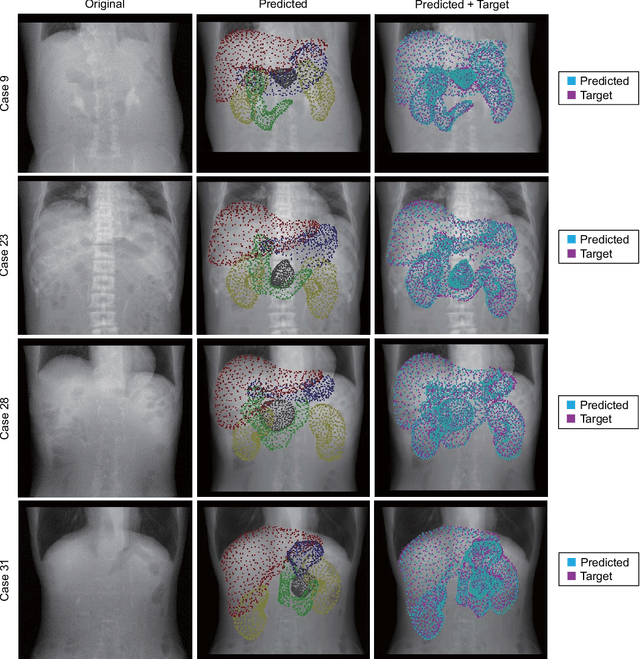 Figure 2 for IGCN: Image-to-graph Convolutional Network for 2D/3D Deformable Registration