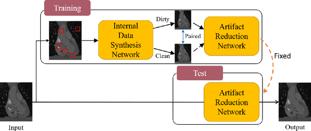 Figure 1 for "One-Shot" Reduction of Additive Artifacts in Medical Images
