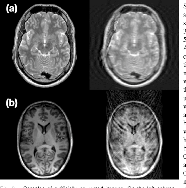 Figure 2 for Automated SSIM Regression for Detection and Quantification of Motion Artefacts in Brain MR Images