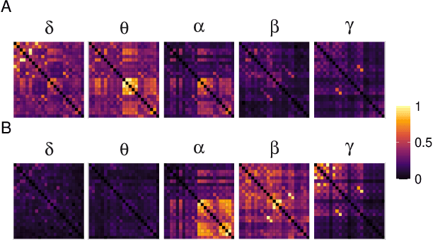 Figure 2 for Bispectrum-based Cross-frequency Functional Connectivity: Classification of Alzheimer's disease