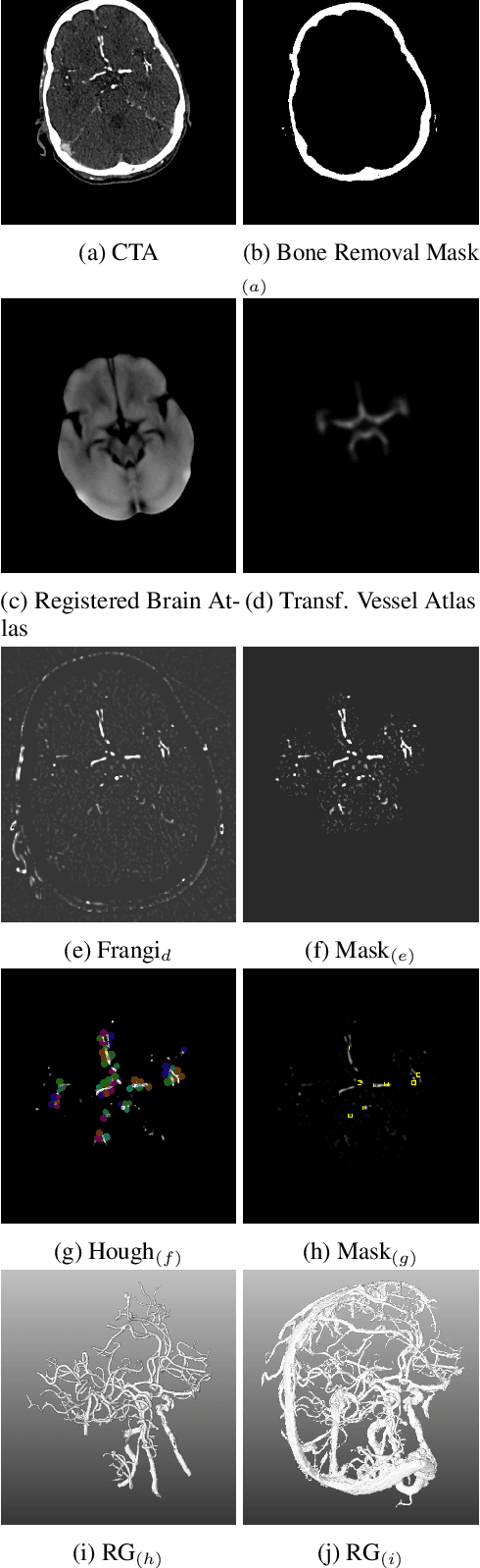 Figure 3 for An Algorithm for the Labeling and Interactive Visualization of the Cerebrovascular System of Ischemic Strokes