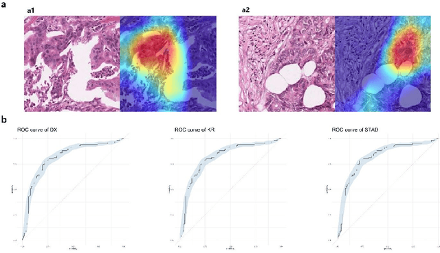 Figure 1 for Computational analysis of pathological image enables interpretable prediction for microsatellite instability