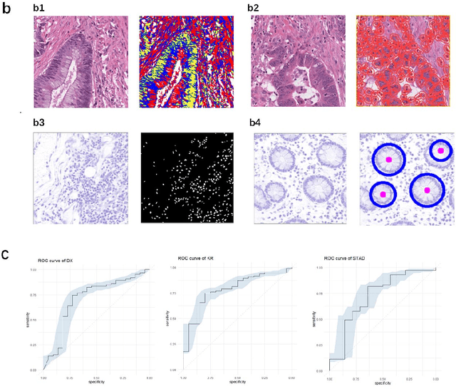 Figure 2 for Computational analysis of pathological image enables interpretable prediction for microsatellite instability