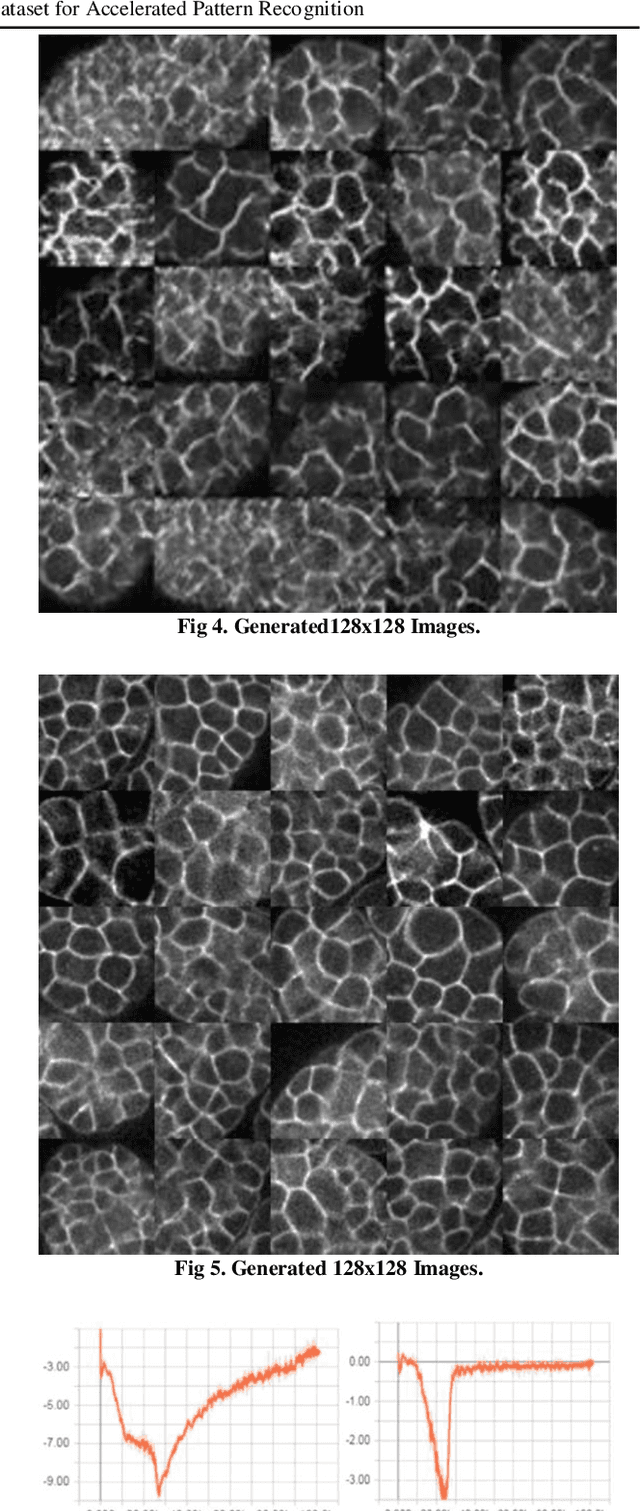 Figure 4 for Augmenting C. elegans Microscopic Dataset for Accelerated Pattern Recognition