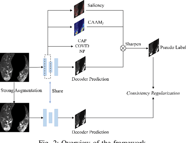 Figure 2 for Explainable COVID-19 Infections Identification and Delineation Using Calibrated Pseudo Labels