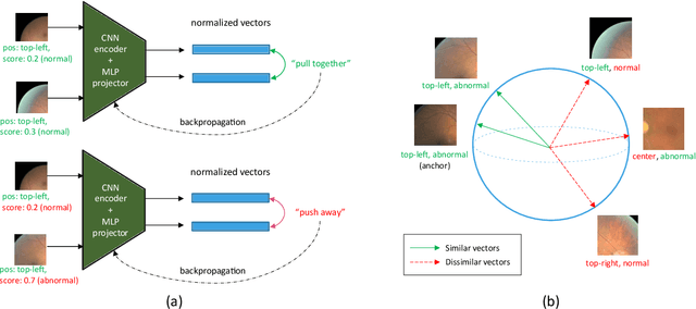 Figure 2 for Semi-weakly Supervised Contrastive Representation Learning for Retinal Fundus Images