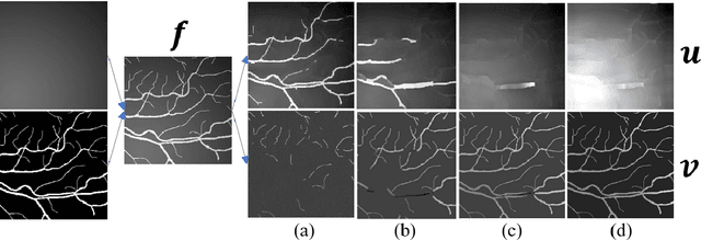 Figure 1 for IDmUNet: A new image decomposition induced network for sparse feature segmentation