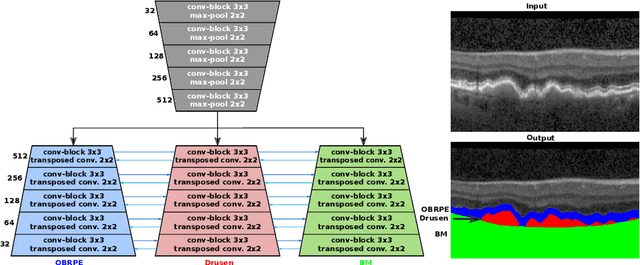 Figure 3 for Multiclass segmentation as multitask learning for drusen segmentation in retinal optical coherence tomography