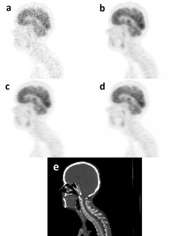 Figure 1 for Does prior knowledge in the form of multiple low-dose PET images improve standard-dose PET prediction?
