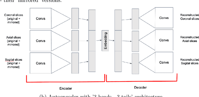 Figure 3 for Convolutional neural networks for automatic detection of Focal Cortical Dysplasia