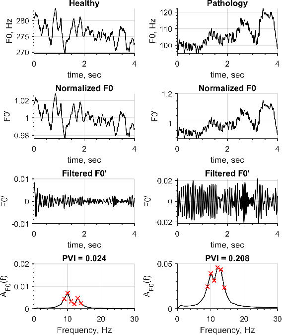 Figure 2 for Bulbar ALS Detection Based on Analysis of Voice Perturbation and Vibrato
