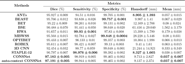 Figure 4 for Convolutional Neural Networks for Skull-stripping in Brain MR Imaging using Consensus-based Silver standard Masks