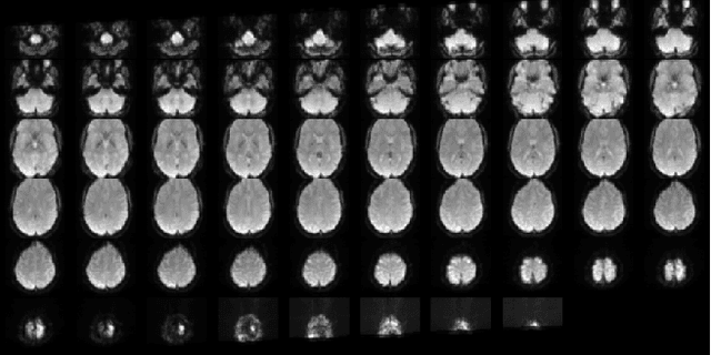 Figure 3 for Multi-site Diagnostic Classification Of Schizophrenia Using 3D CNN On Aggregated Task-based fMRI Data