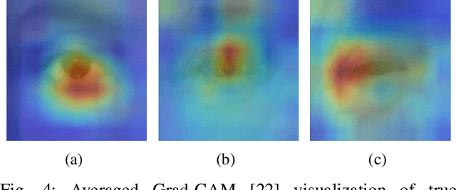 Figure 4 for Investigating Fairness of Ocular Biometrics Among Young, Middle-Aged, and Older Adults