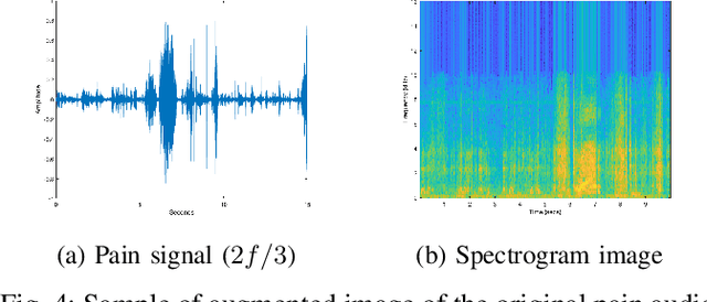 Figure 4 for Harnessing the Power of Deep Learning Methods in Healthcare: Neonatal Pain Assessment from Crying Sound