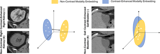 Figure 1 for Adaptive Contrastive Learning with Dynamic Correlation for Multi-Phase Organ Segmentation