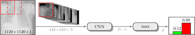 Figure 3 for Deep Learning for Pneumothorax Detection and Localization in Chest Radiographs