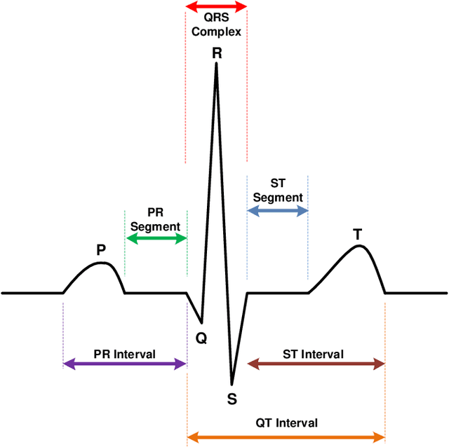 Figure 3 for Detection and Prediction of Cardiac Anomalies Using Wireless Body Sensors and Bayesian Belief Networks