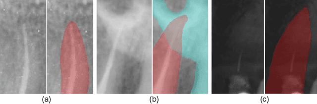 Figure 1 for GT U-Net: A U-Net Like Group Transformer Network for Tooth Root Segmentation